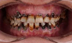 Любовь Никитина