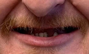 Николай Разумов