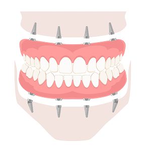 Обеих челюстей
