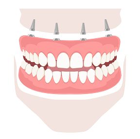 Верхней челюсти